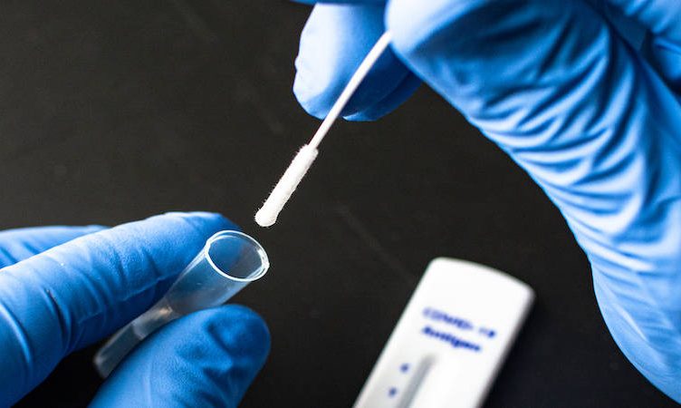 IATA urges governments to accept rapid testing for safe restart to travel; welcomes new director general