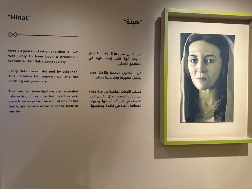 Hinat, before and after the facial reconstruction process which is explained in a video on-site.